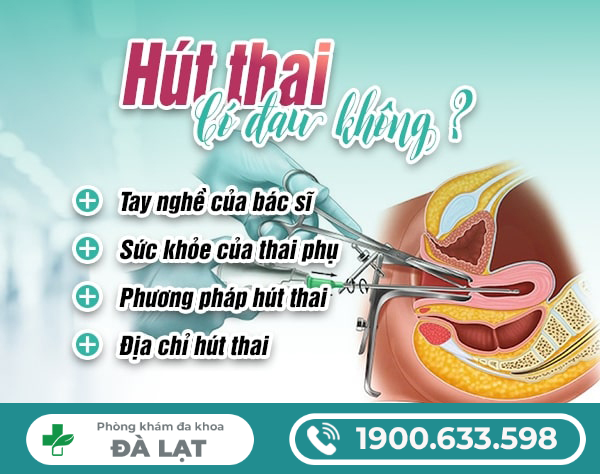 Hình ảnh minh họa
